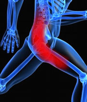 درد عصب سیاتیک2